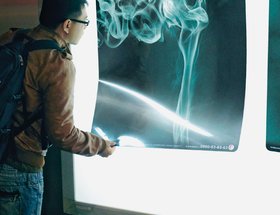 X-Ray Photo Light Box